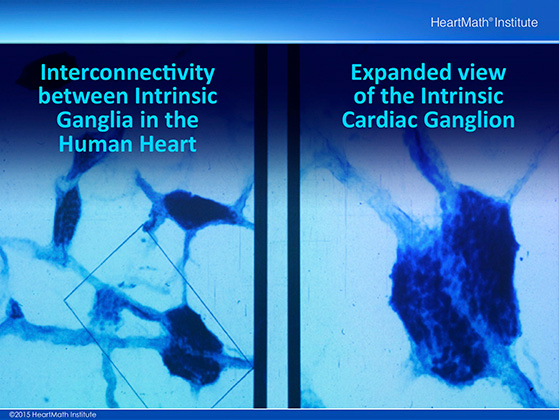 Little Brain in the Heart-Neuron-slide-1 