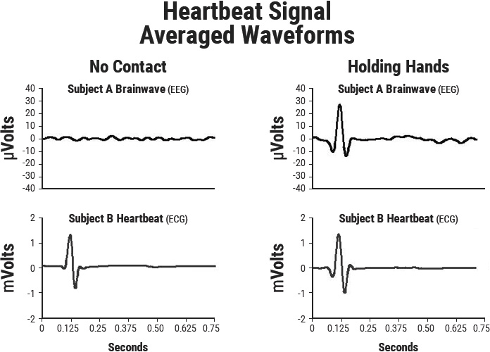 Heartbeat Signal-Averaged Waveforms